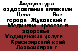 Акупунктура, оздоровление пиявками › Цена ­ 3 000 - Все города, Жуковский г. Медицина, красота и здоровье » Медицинские услуги   . Красноярский край,Лесосибирск г.